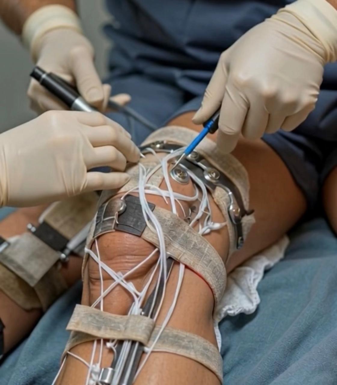 ACL reconstruction surgery showing knee ligament repair and recovery process.