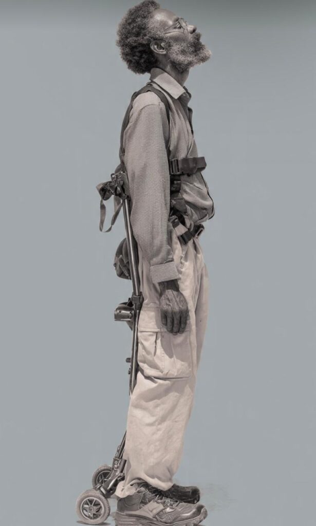 Amyotrophic Lateral Sclerosis