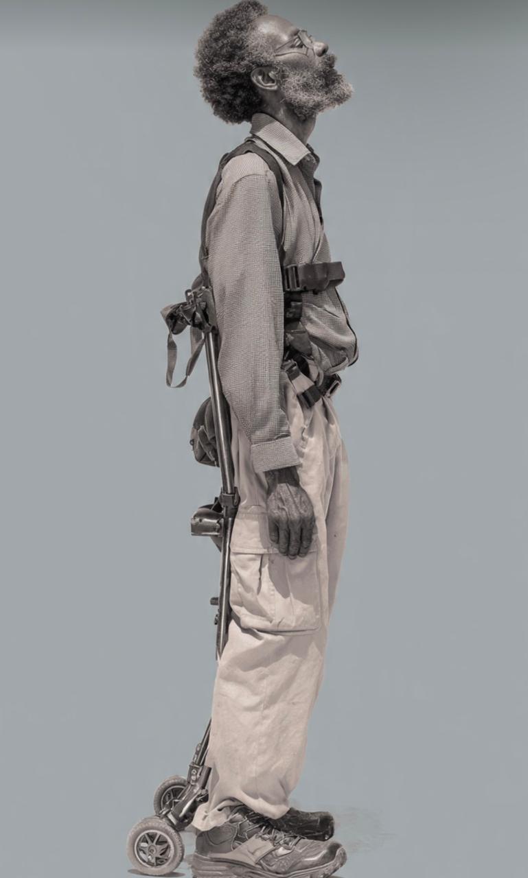 Amyotrophic Lateral Sclerosis (ALS)