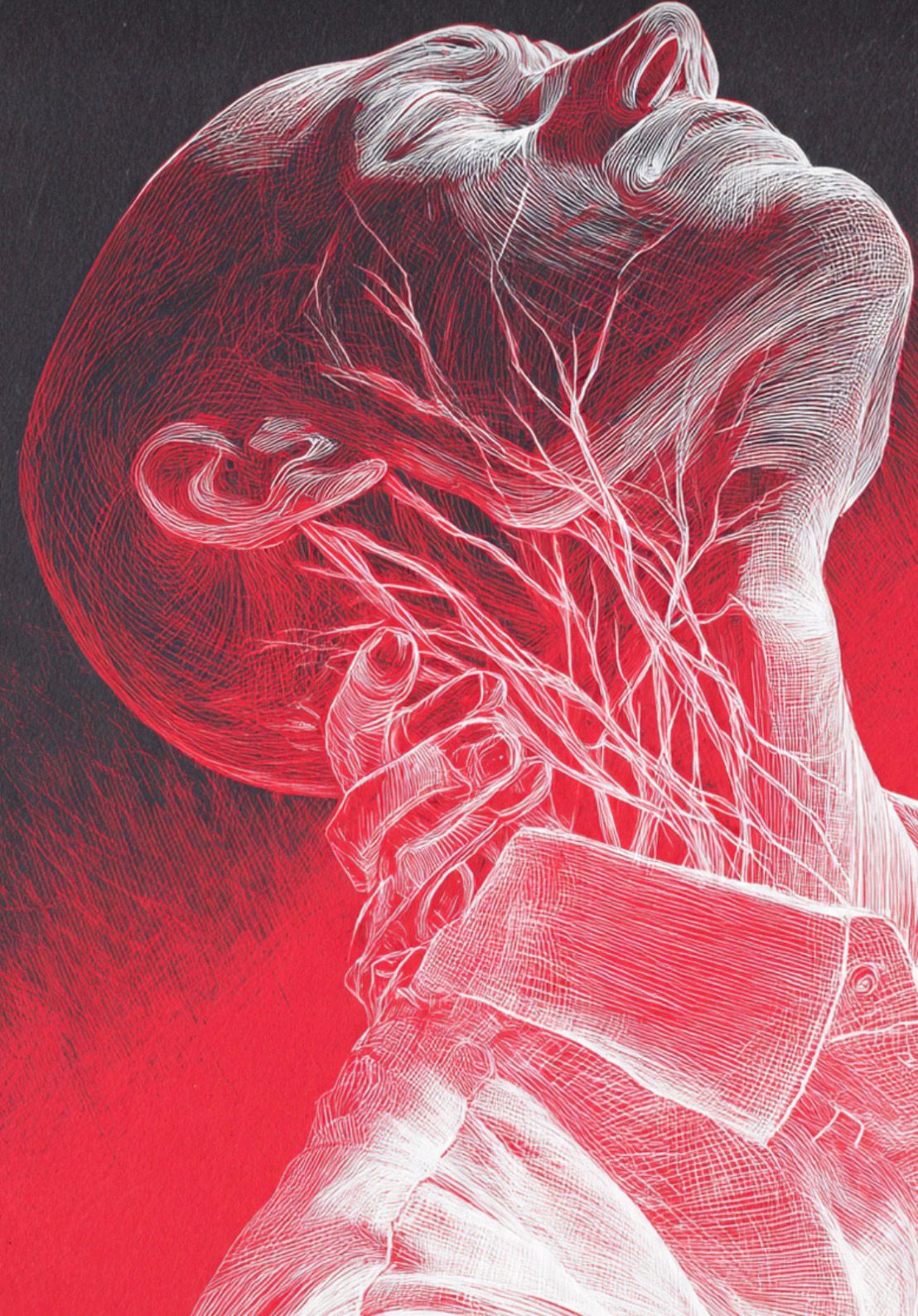 acute whiplash injury neck pain